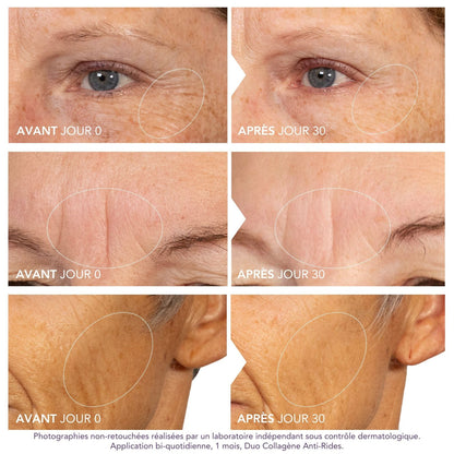 Routine Lissante Anti Rides